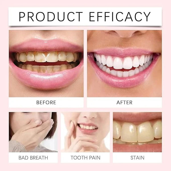 Oralhoe - Nicotinamide Dazzle White Toothpaste