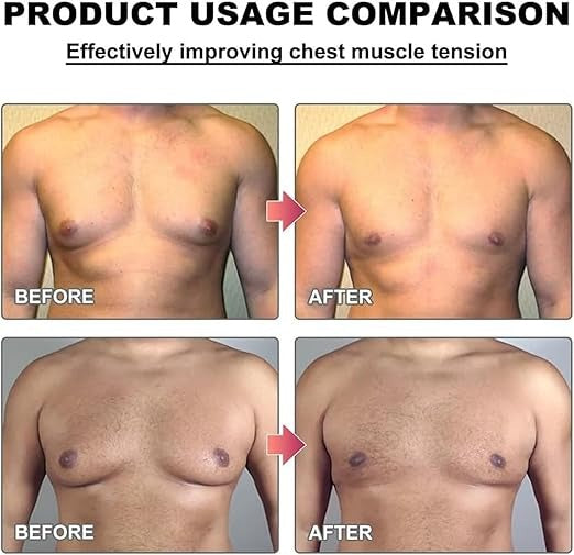 Men Therm Bee Venom Gynecomastia Heating Oil